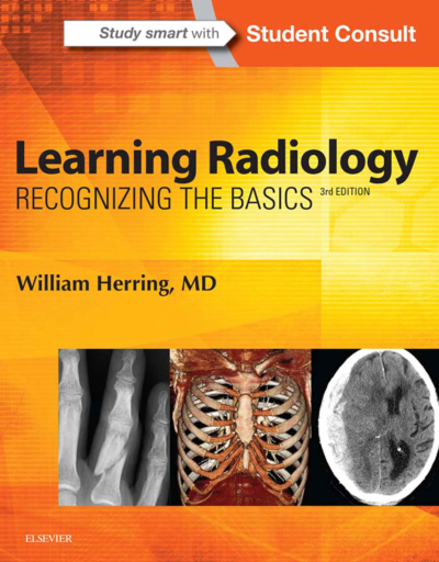 Learning Radiology: Recognizing The Basics / William Herring Zeta Fotokopi